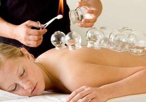 Gua Sha (Gwa'Sha') and Cupping